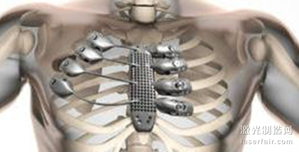 1512097125388573.png 21-32-35-79-13.png